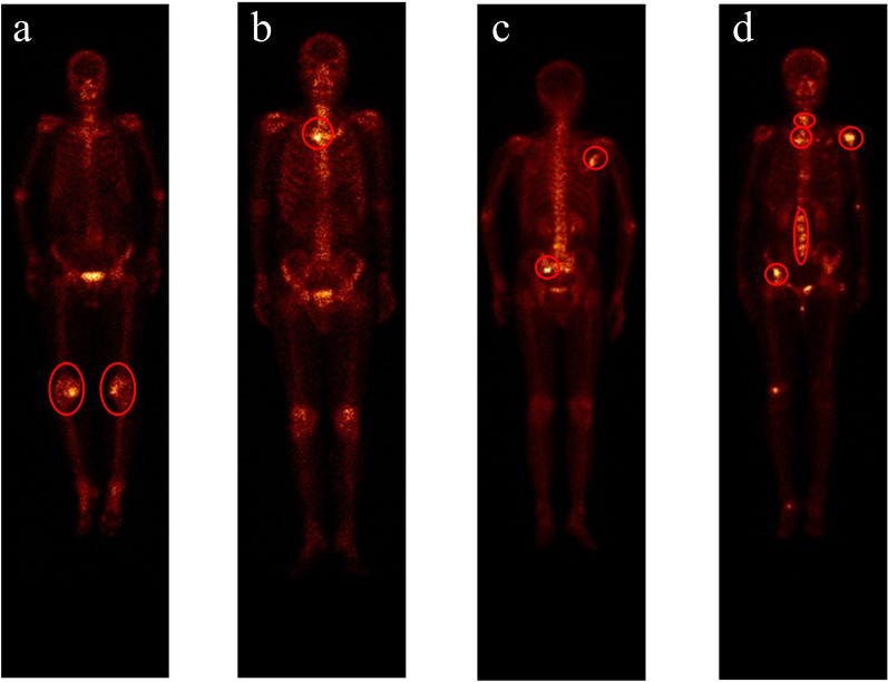 Fig. 11