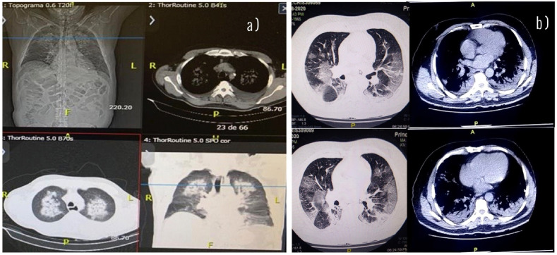 Fig. 1