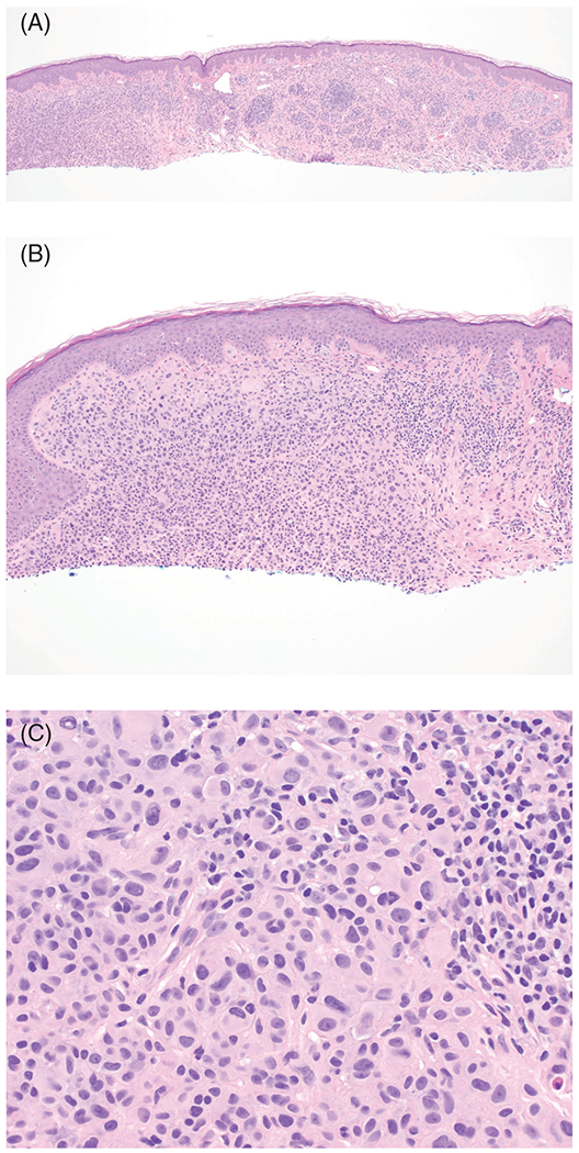 FIGURE 2