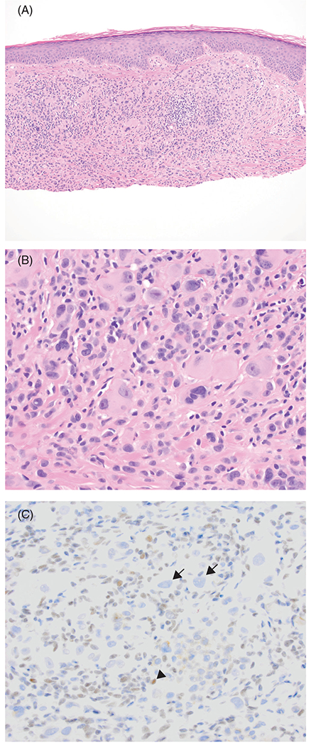 FIGURE 3