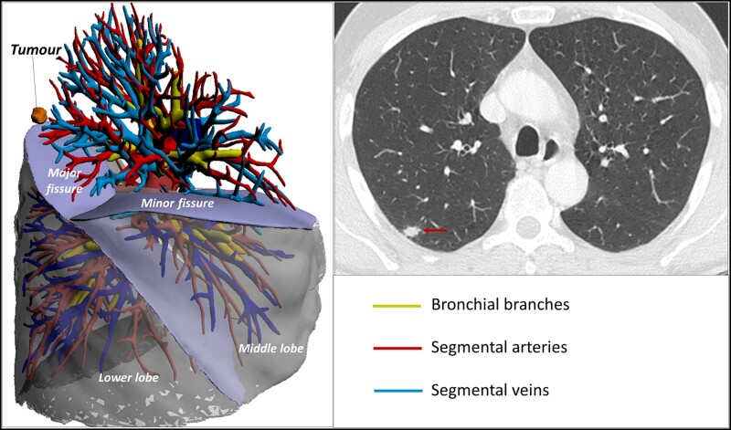 Figure 1: