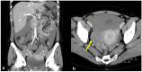 Figure 19