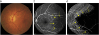 Fig. 41