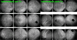 Fig. 11