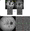 Fig. 20