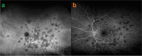 Fig. 18