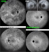 Fig. 30