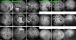 Fig. 32