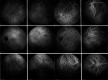 Fig. 38