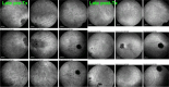 Fig. 12