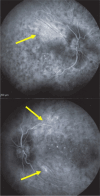 Fig. 24