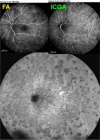 Fig. 15