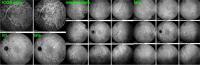 Fig. 28