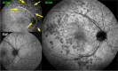 Fig. 16