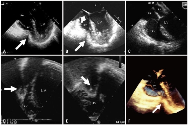 Fig. 5