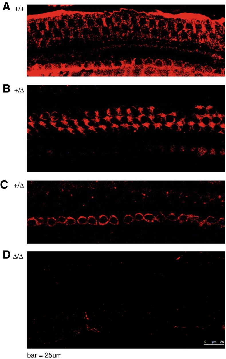 FIG. 11