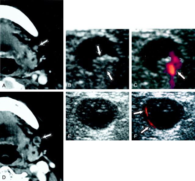 Fig 1.