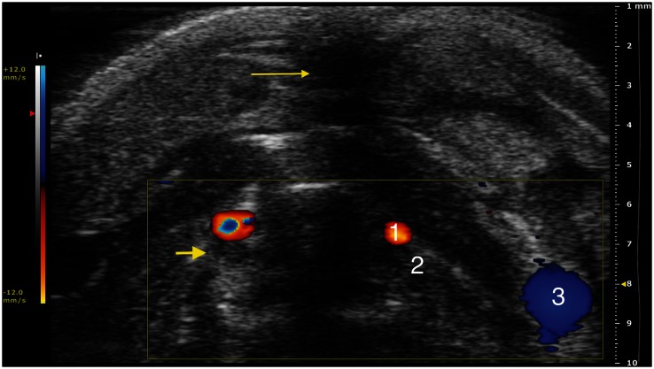 Figure 4