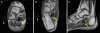Fig. 1