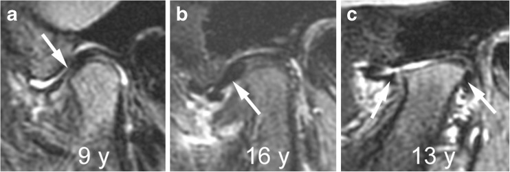 Fig. 24