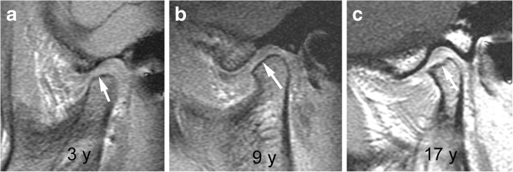 Fig. 20