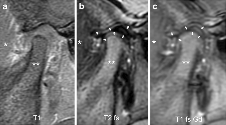 Fig. 11