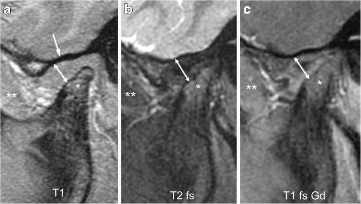 Fig. 16