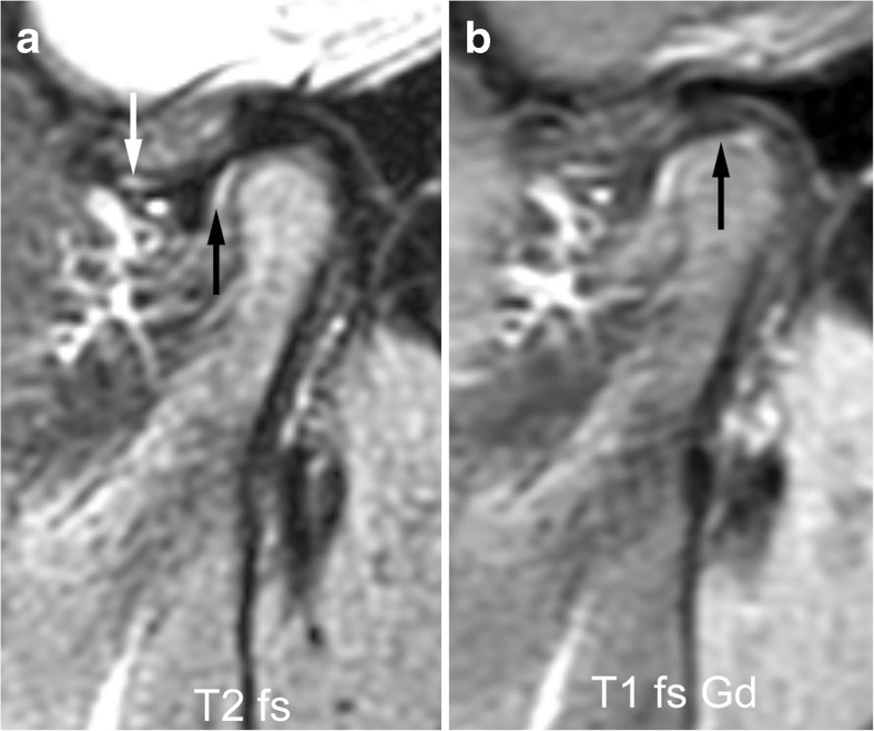 Fig. 12