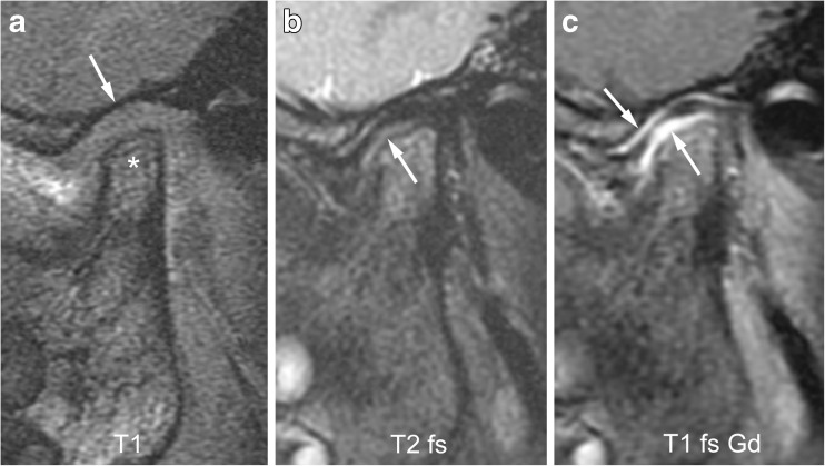 Fig. 14