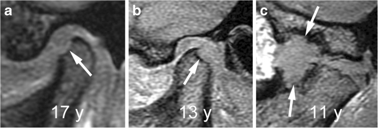 Fig. 23