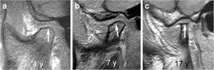 Fig. 21