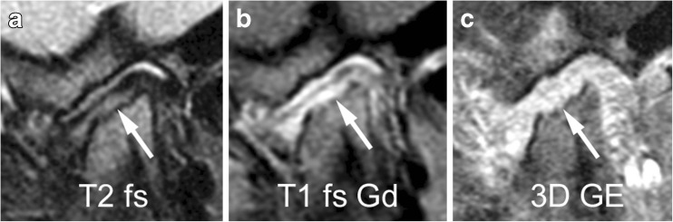 Fig. 22