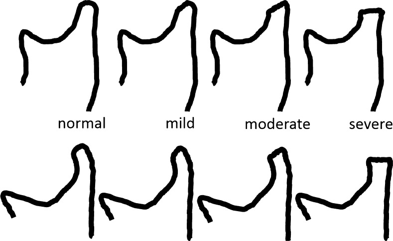 Fig. 17