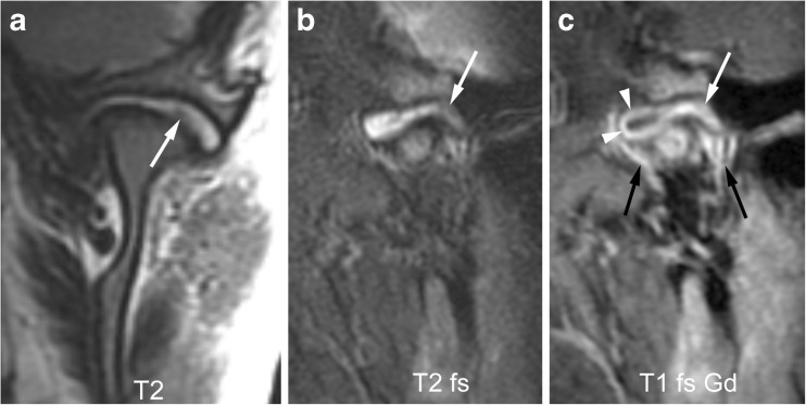 Fig. 13