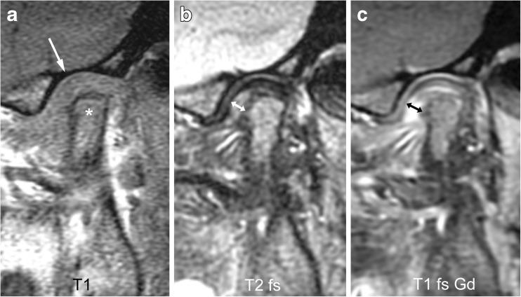 Fig. 15