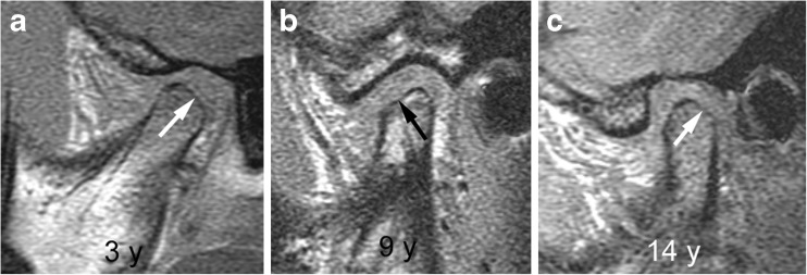 Fig. 19