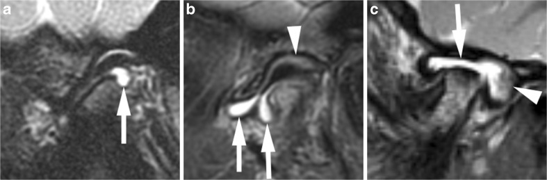 Fig. 10