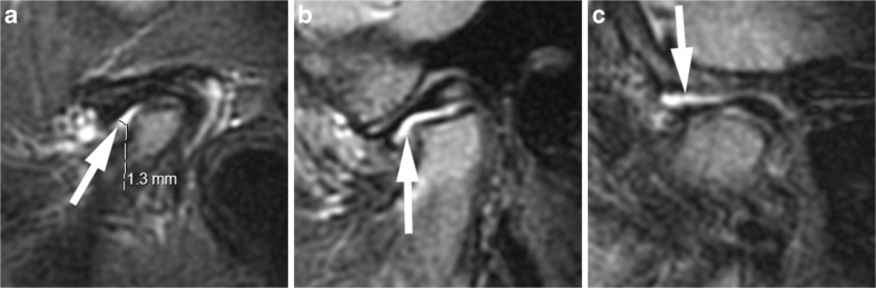 Fig. 9