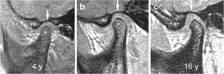 Fig. 18