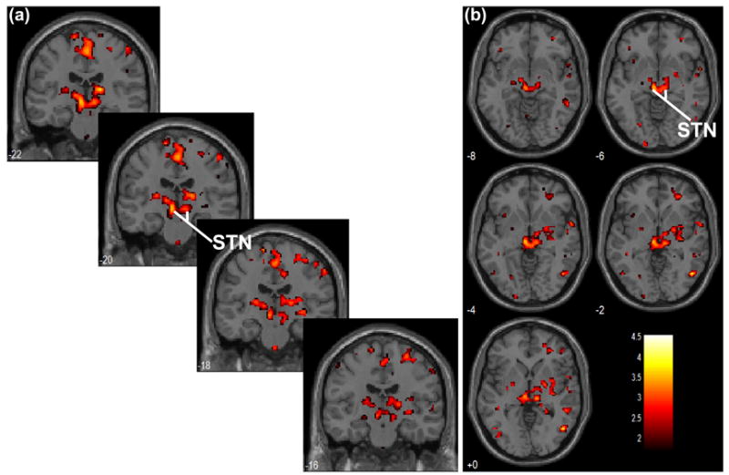 FIGURE 3