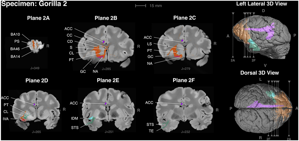 Figure 2 -