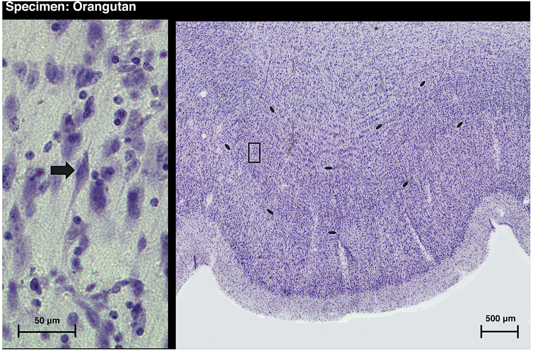 Figure 1 -