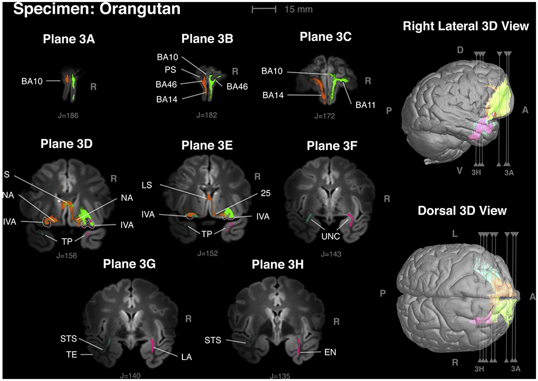 Figure 3 -