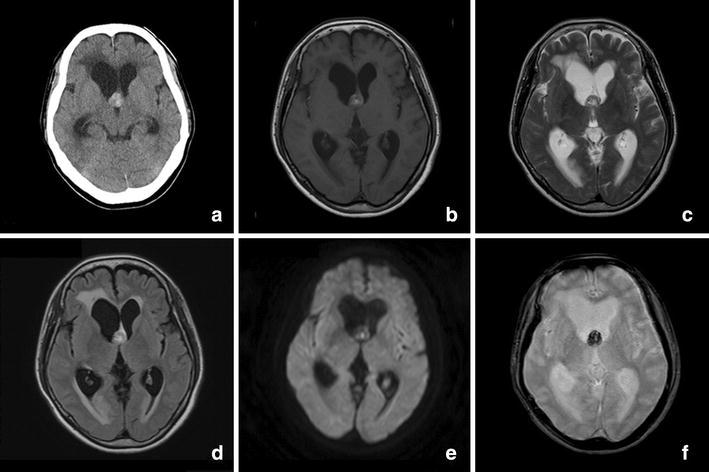 Fig. 1