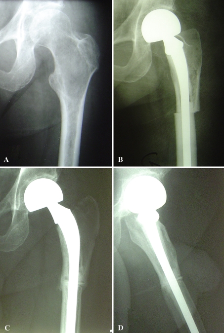 Fig. 3A–D