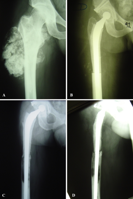 Fig. 2A–D