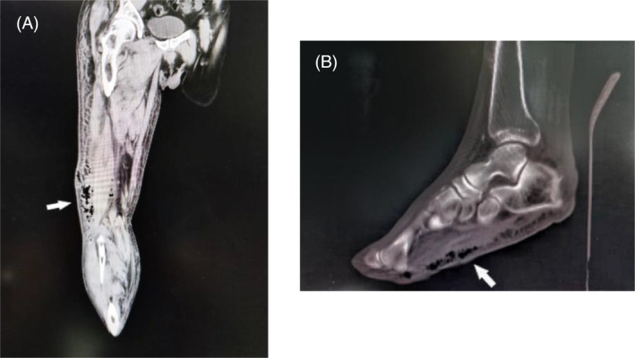 FIGURE 3