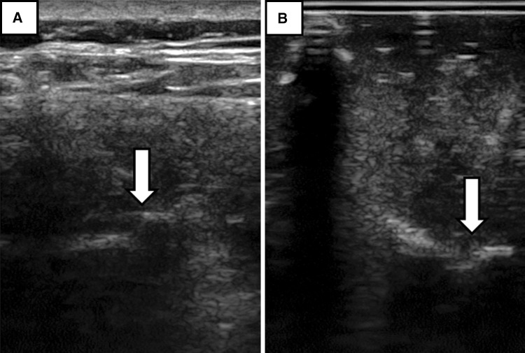 Fig. 3A–B