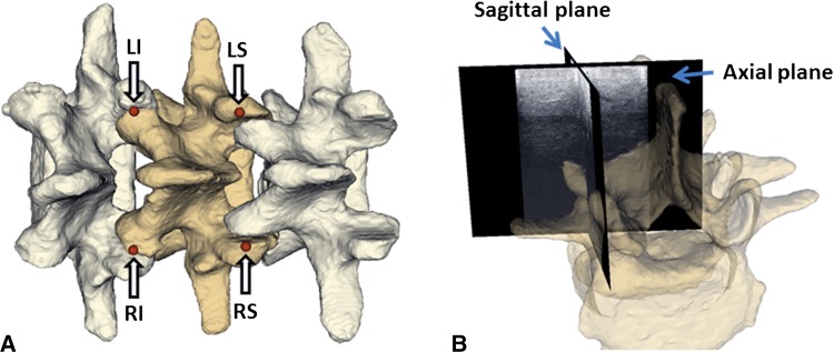 Fig. 2A–B