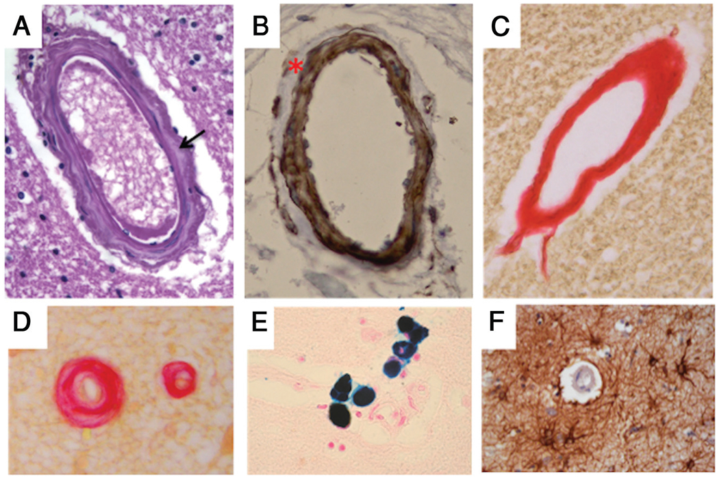 FIG 3.